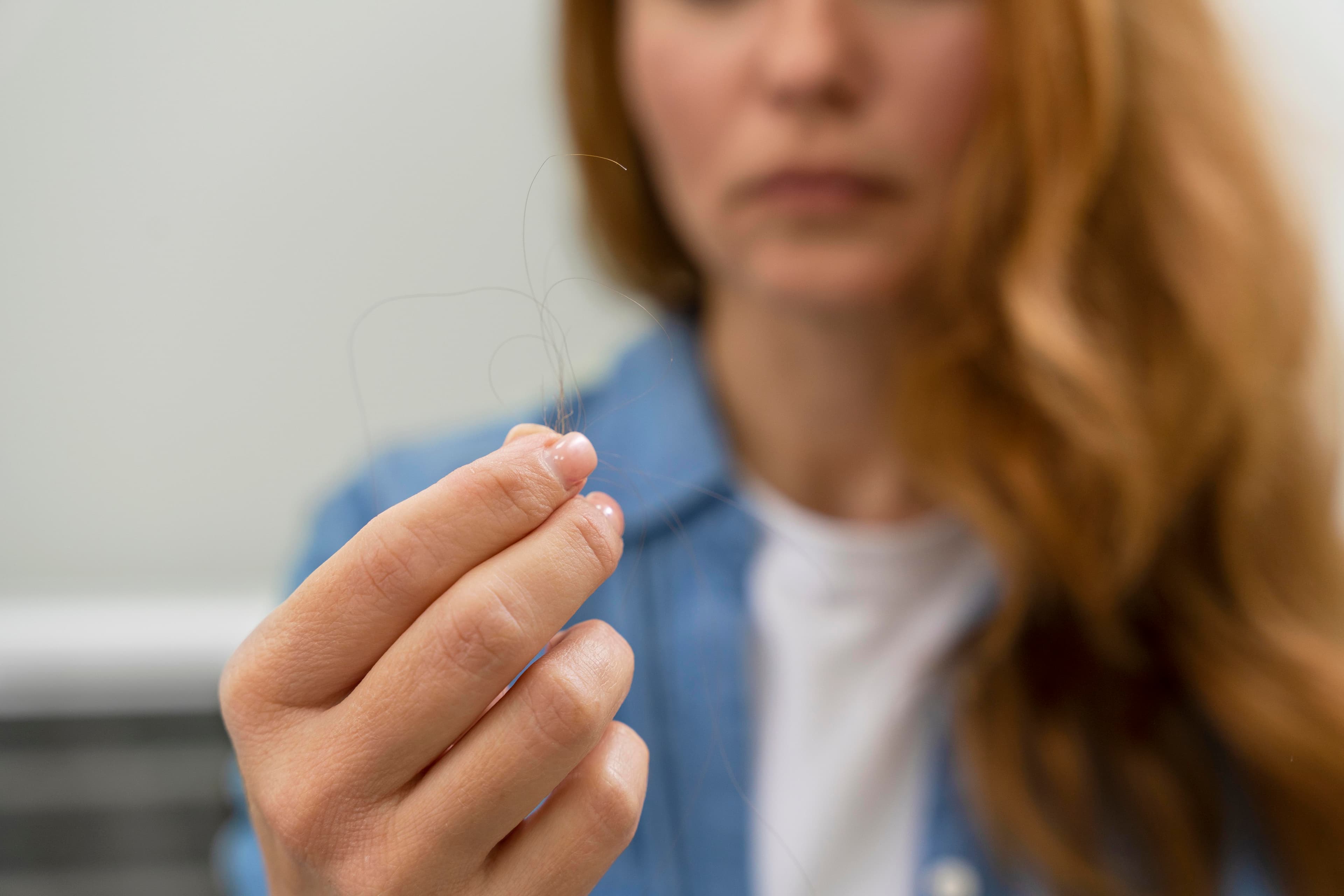 Can Diabetes Cause Hair Loss?